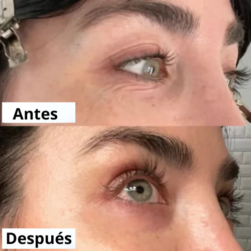 PARCHES SUAVIZANTES DE ARRUGAS - FRENTE Y OJOS